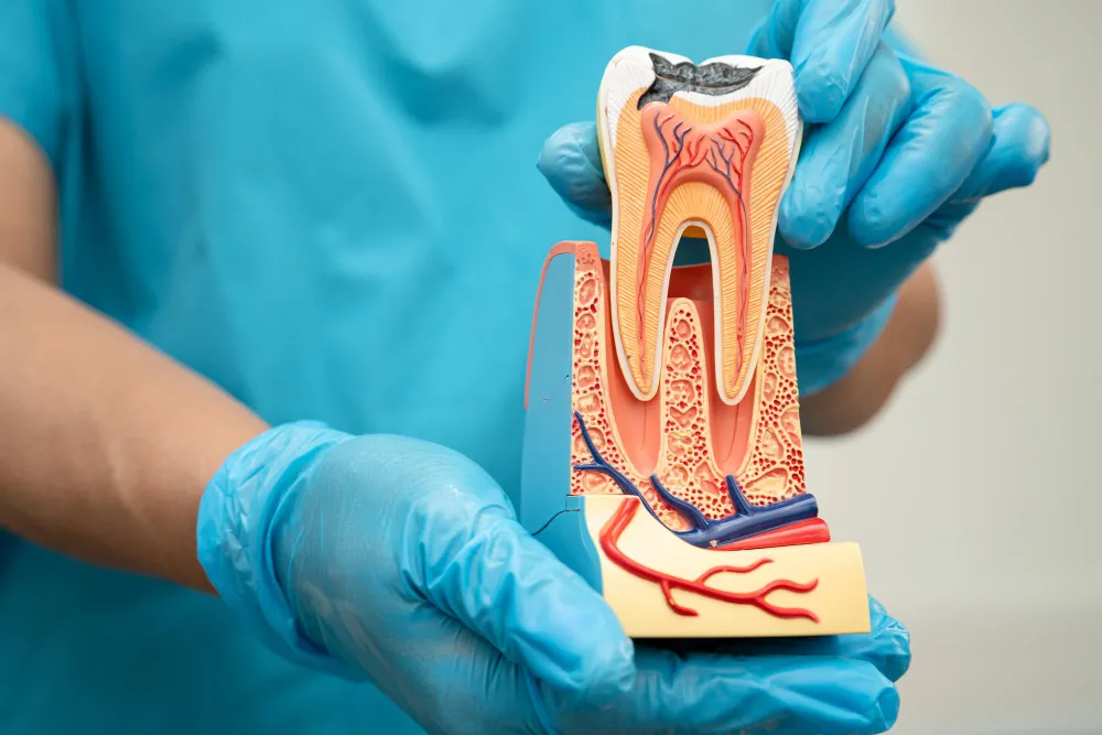 Bone Graft for Teeth