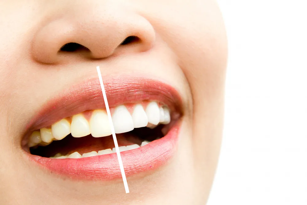 Remove Brown Stains