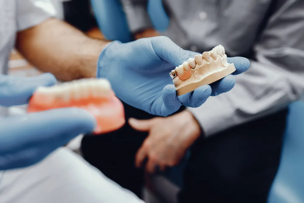 Dental Crowns