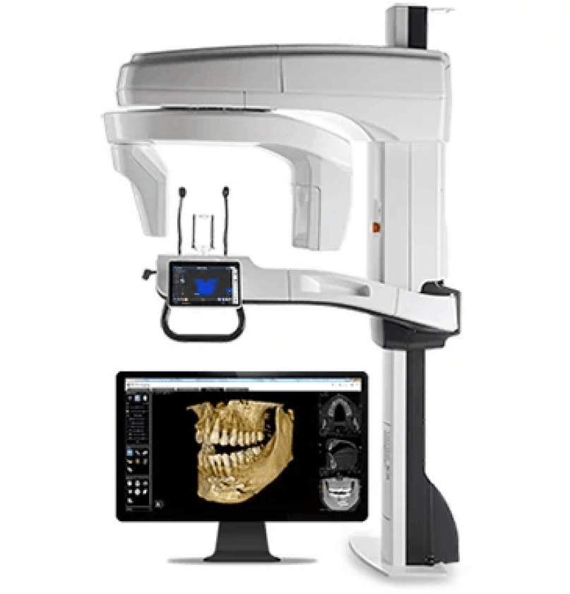 Cone-Beam Computed Tomography (CBCT)