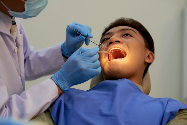 What to Eat After a Root Canal: Recovery Tips & What to Avoid