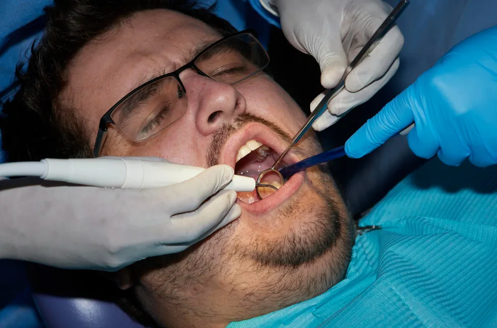 Wisdom Teeth Removal