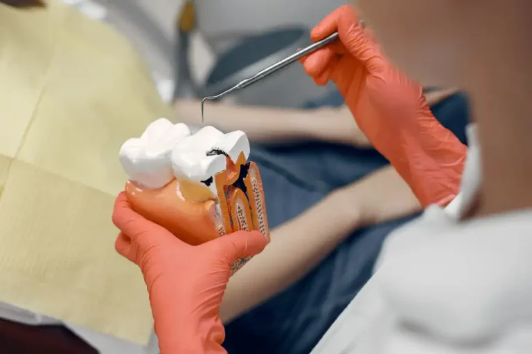 Dentists Repair Cracked Teeth