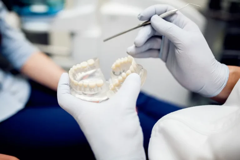What Is a Dental Onlay