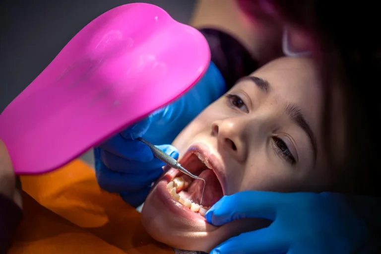 How Long Does It Take to Fill a Cavity?
