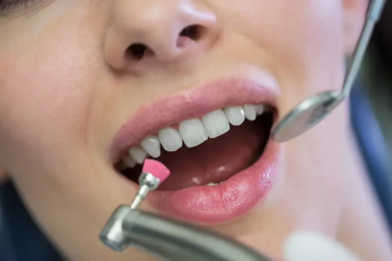 Dental Crowns Last