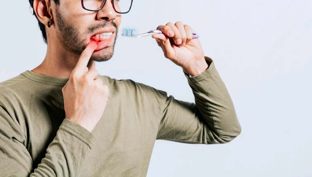 Signs of Periodontal Disease