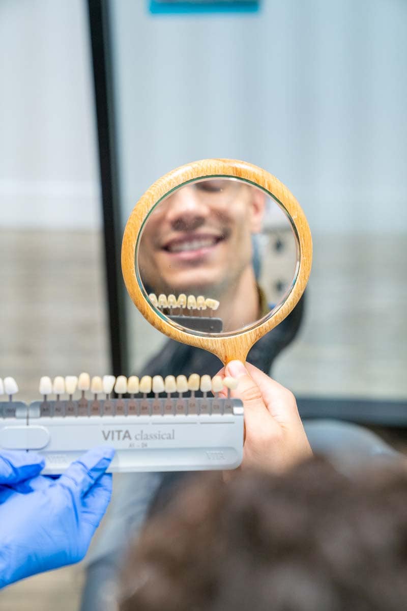 are-veneers-permanent-patient-mirror