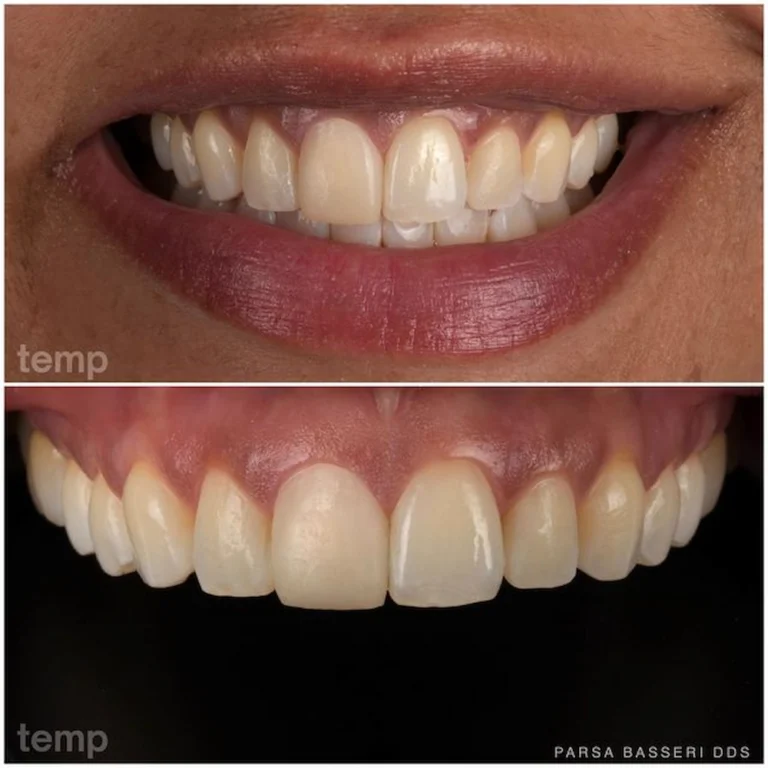cosmetic-dentist-manhattan-nyc-union-square