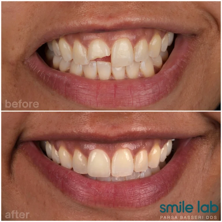 cosmetic-dentist-manhattan-nyc-union-square
