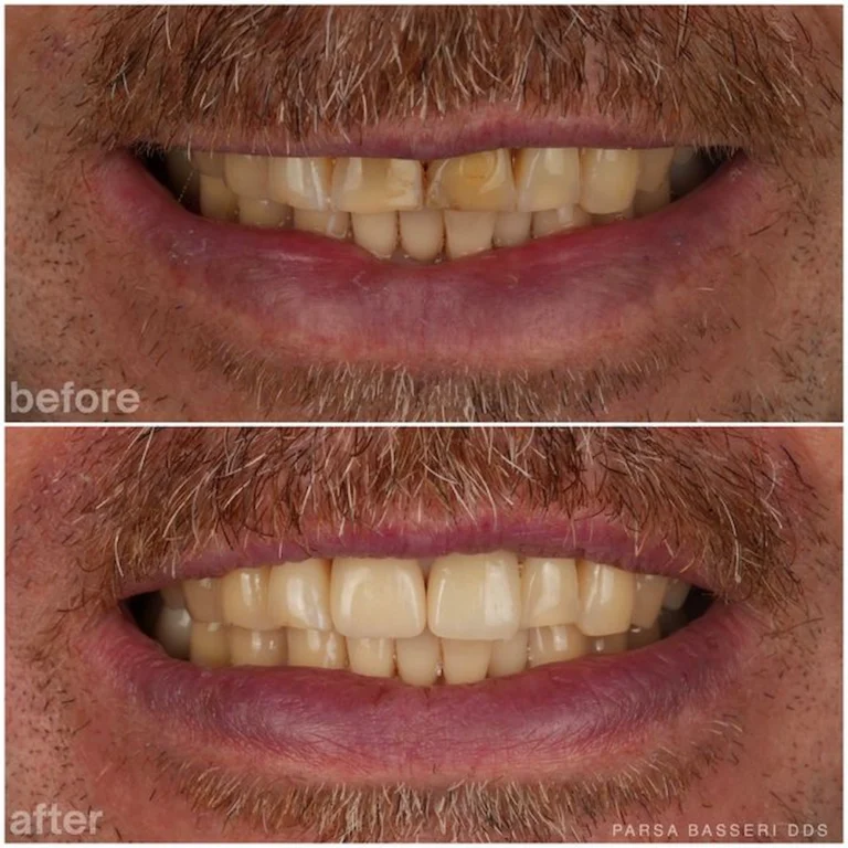 cosmetic-dentist-manhattan-nyc-union-square