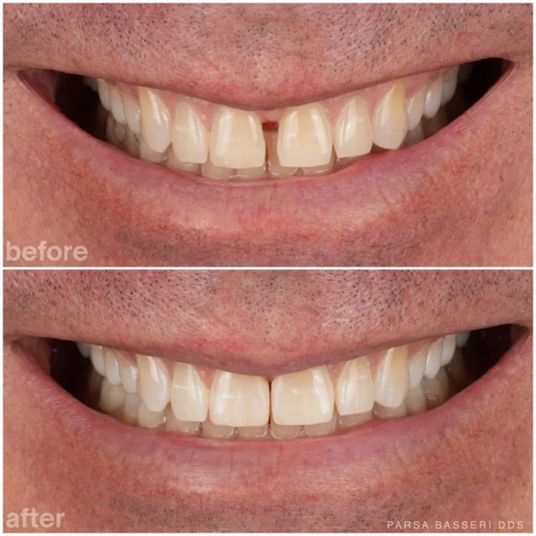 cosmetic-dentist-manhattan-nyc-union-square