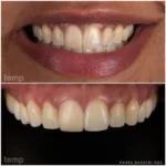 dentist-in-union-square-ny