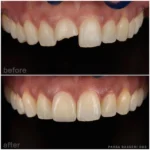 dentist-in-union-square-ny