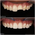 dentist-in-union-square-ny