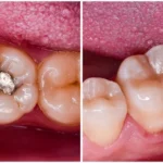 dentist-in-union-square-ny